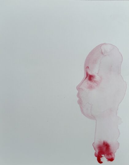 Tal Regev - Small injury